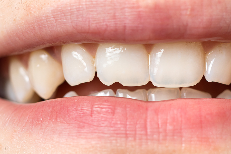 Park Creek Dental Care