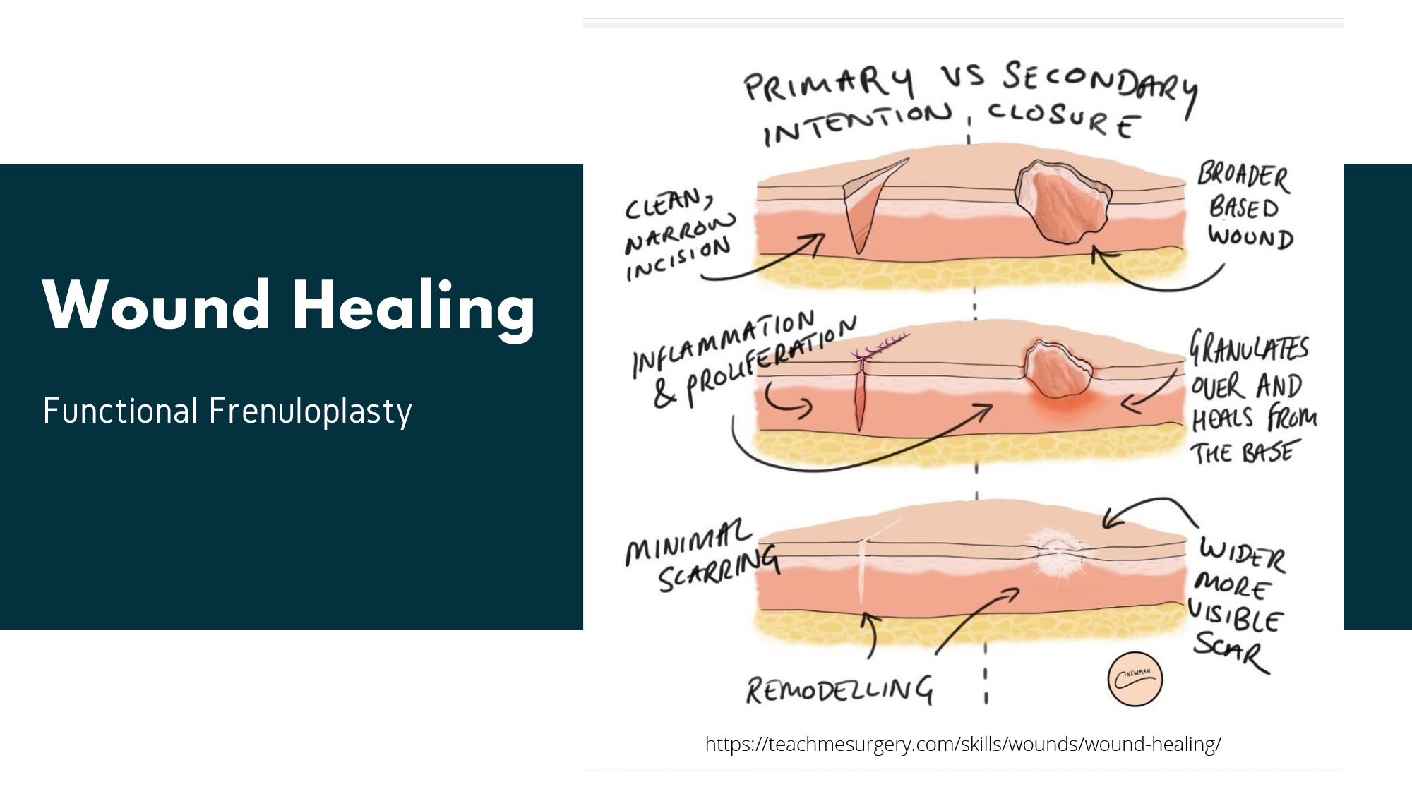 How To Access Research  NW Myofunctional Therapy Portland, OR