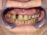 texassage dentistry image texassage dentistry image