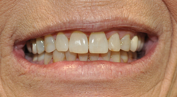 Smile Gallery
