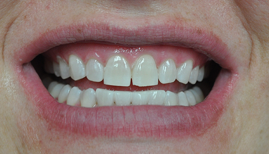 Smile Gallery
