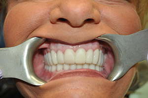 Smile Gallery