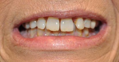 Smile Gallery
