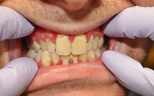 Smile Gallery