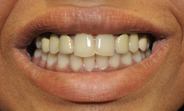 Smile Gallery