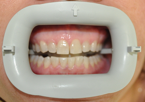 Smile Gallery