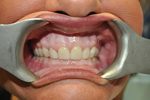 Smile Gallery