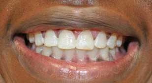 Smile Gallery