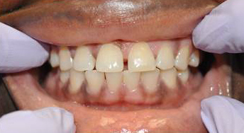 Smile Gallery