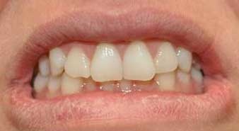 Smile Gallery
