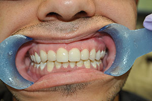 Smile Gallery