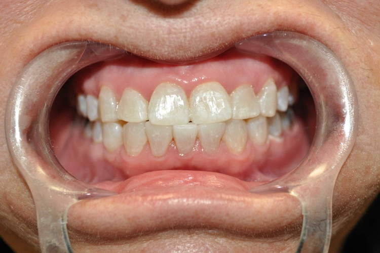 Smile Gallery