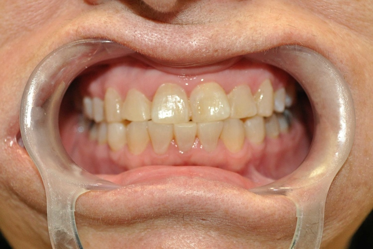 Smile Gallery