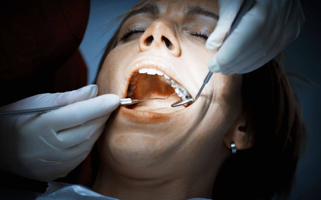 Safely Removing Amalgam Fillings Seattle Dental Care Seattle, WA