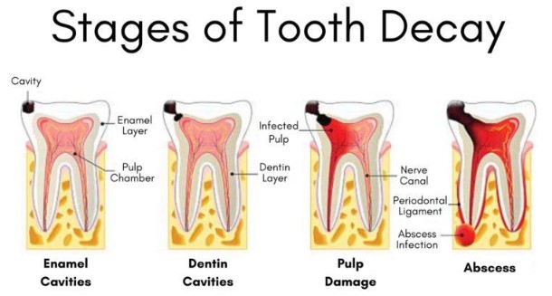 holistic dentist seattle, biological dentist seattle wa holistic dentist seattle, biological dentist seattle wa
