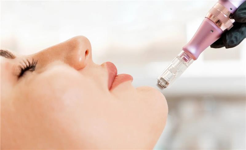 Exosome Add-On Treatment Exosome Add-On Treatment