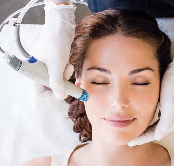 do hydrafacials help with acne scars