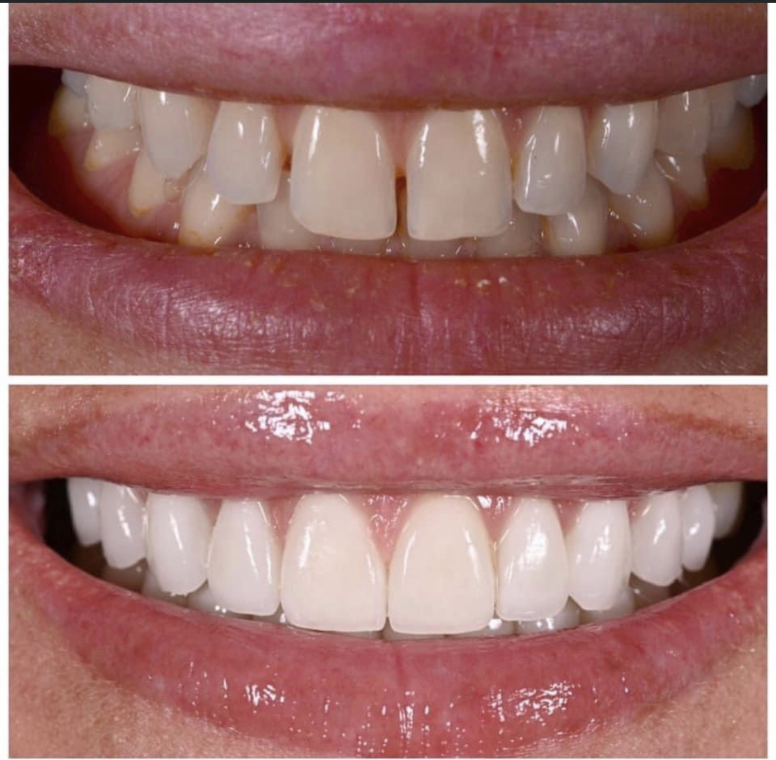 Smile Gallery AC Dentistry Birmingham, AL