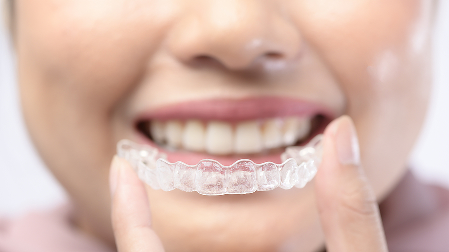 The Do's and Don'ts of Eating with Invisalign