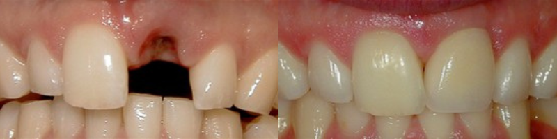 before after images