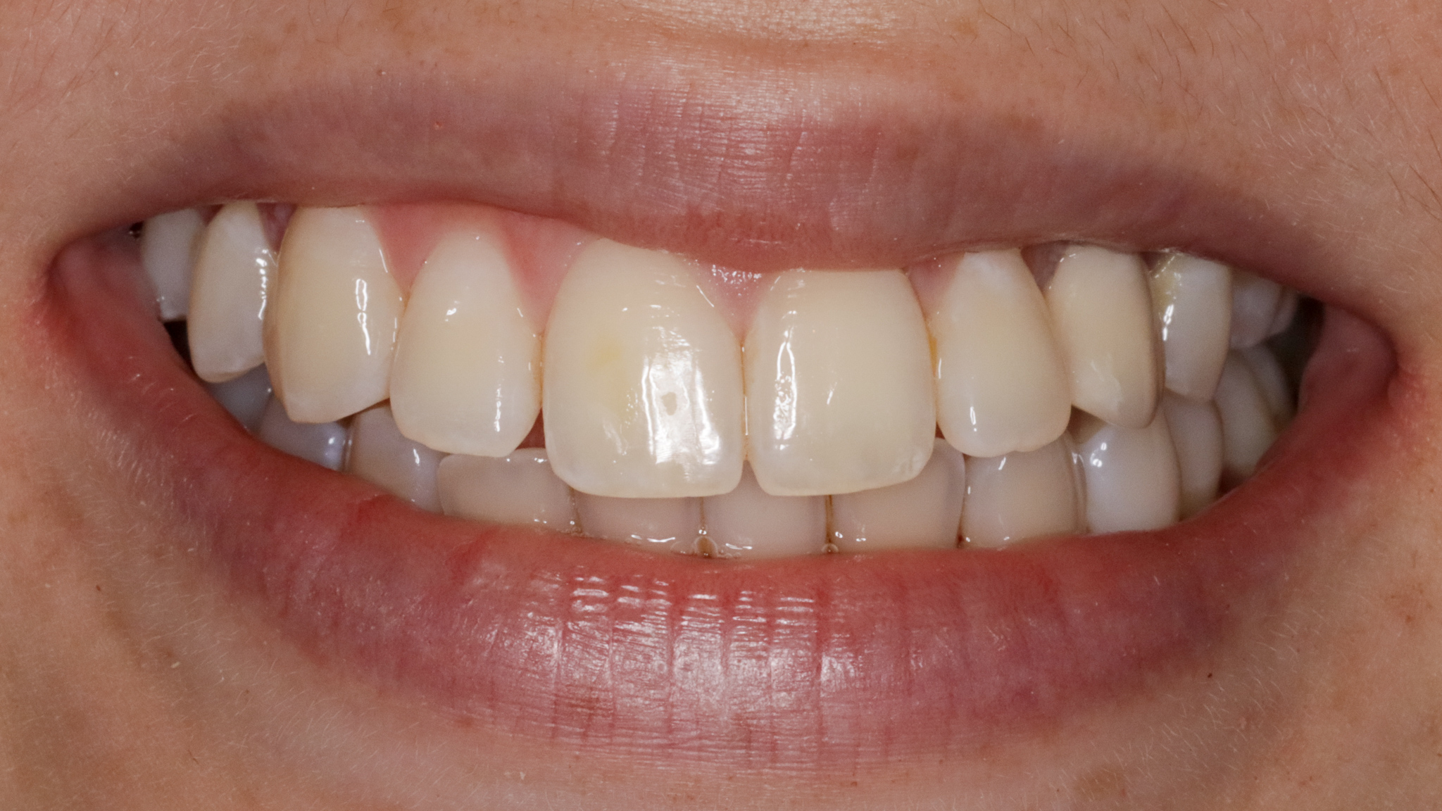 Virtual Consult Charles Street Dental Boston, MA