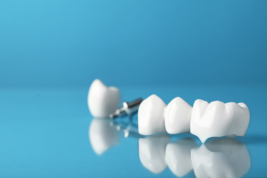 Image related to a dental practice located in St. Louis, MO called Karen Harris