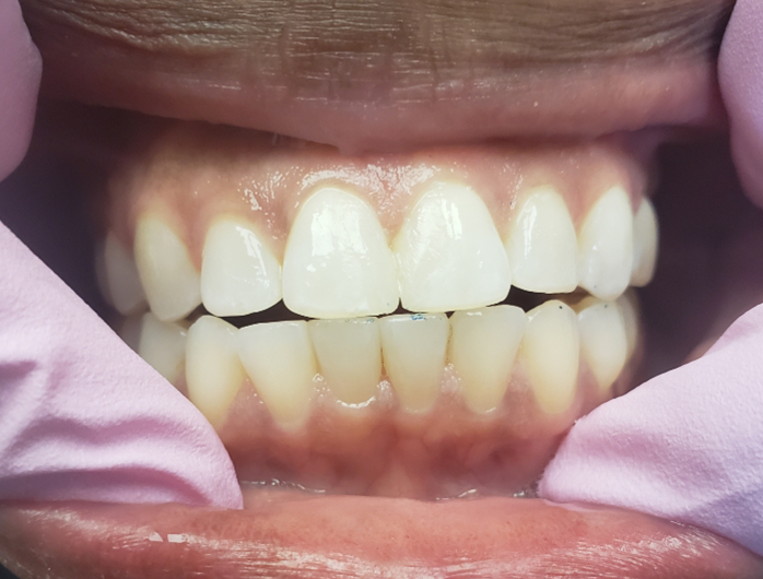 Smile Gallery College Family Dentistry Baton Rouge, LA