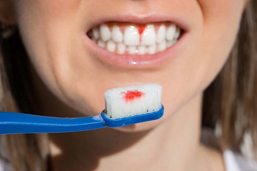 Is gum disease really that common?