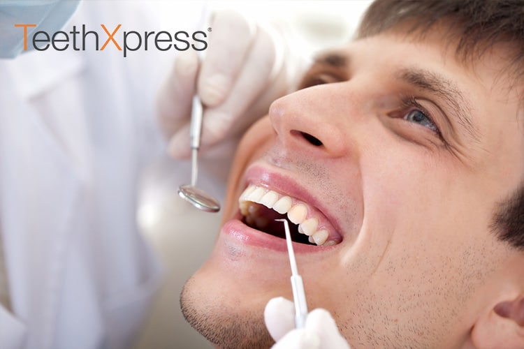 This is a thumbnail image of blog Should You Get TeethXpress?