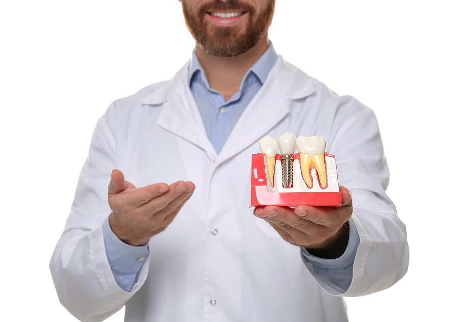 This is a thumbnail image of blog Why Dental Implants are the Best Choice for Missing Teeth This is a thumbnail image of blog Why Dental Implants are the Best Choice for Missing Teeth
