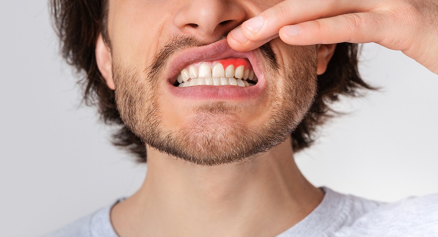 The Top 5 Signs Of Gum Disease