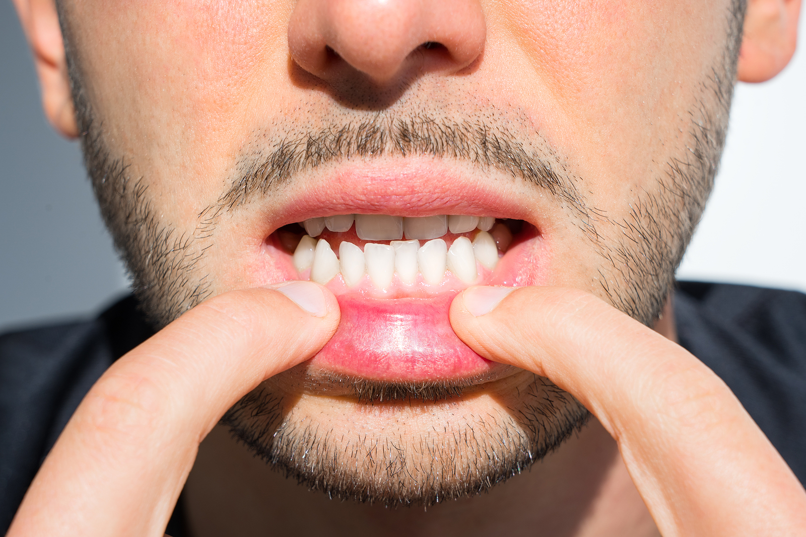 Gum Disease: Warning Signs and Prevention Methods - The New York Times