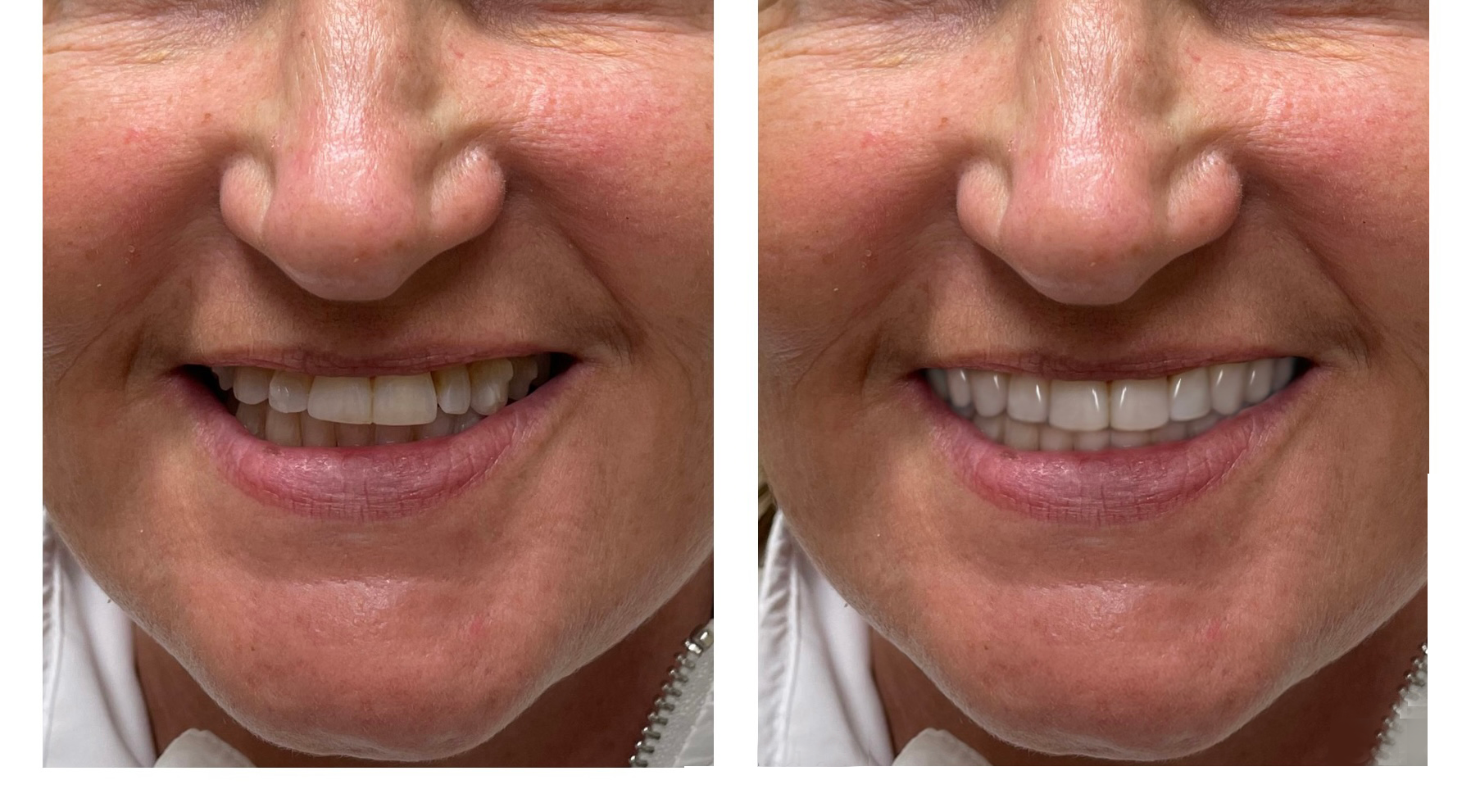 Gardens Dental Spa Gardens Dental Spa
