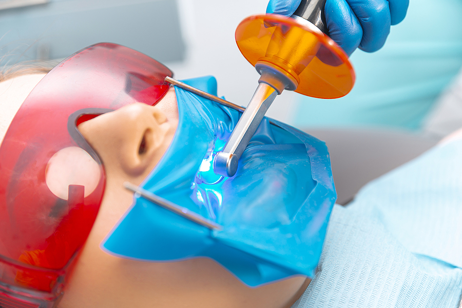 Laser Dentistry in San Jose, CA