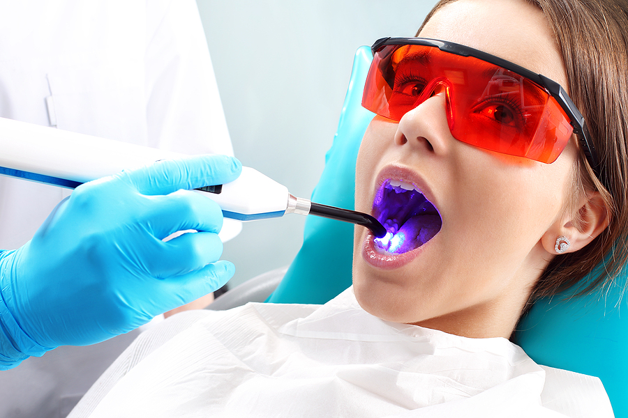 This is a thumbnail image of blog Transforming Smiles with Laser Dentistry in San Jose, CA