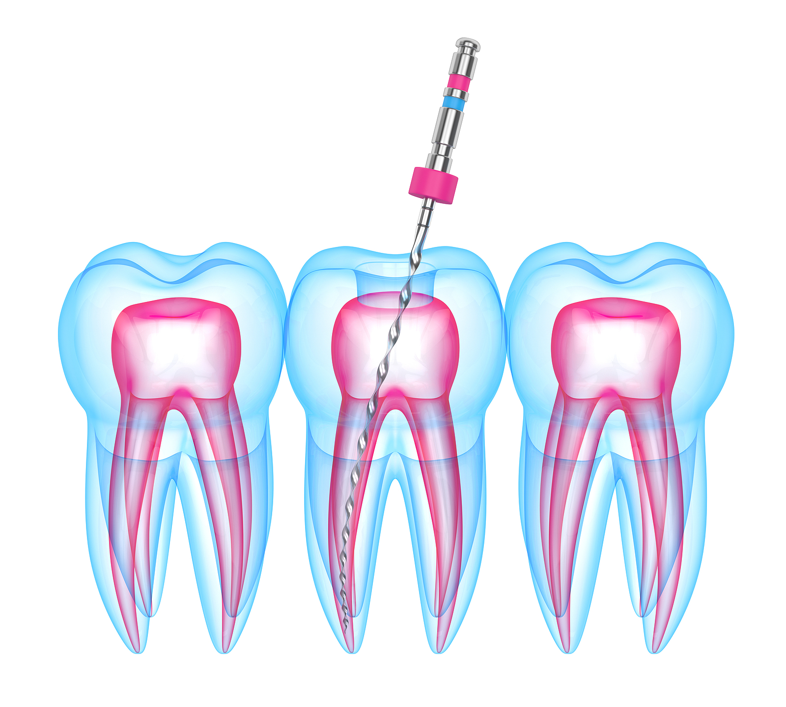 Dentist Hampton, VA William Cheng Hampton, VA Dentist Cheng