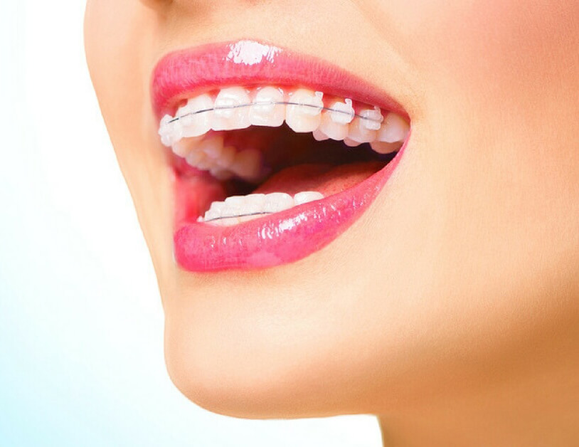 Orthodontist Fresno, CA Mark Lowe DDS Fresno, CA Orthodontist