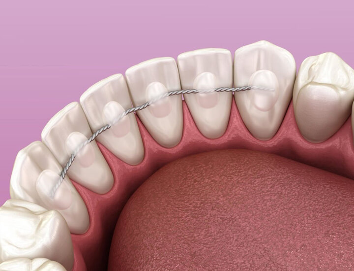 Carroll Orthodontics Carroll Orthodontics