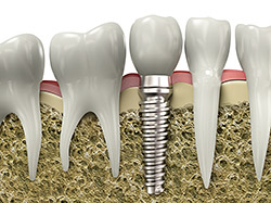 Ash & Rowan Family Dentistry Ash & Rowan Family Dentistry