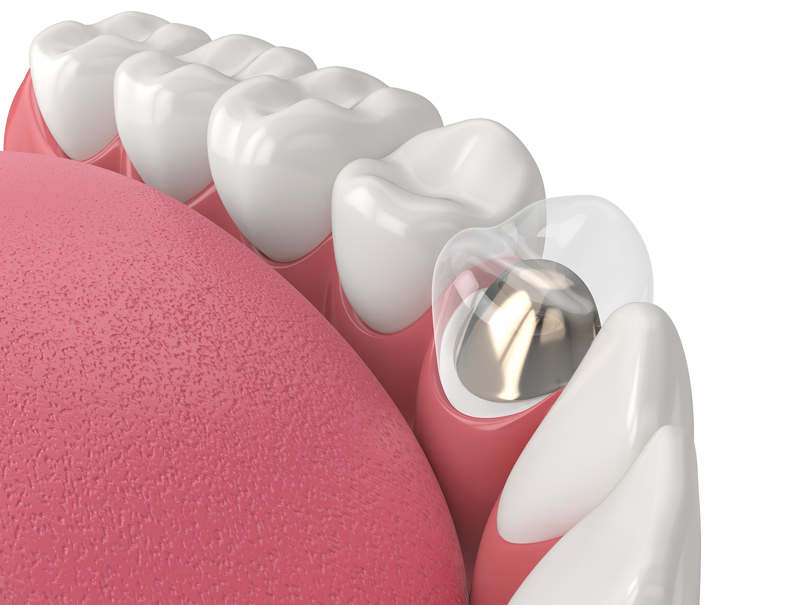 Restorative Dental Treatments