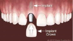 Advanced Dentistry