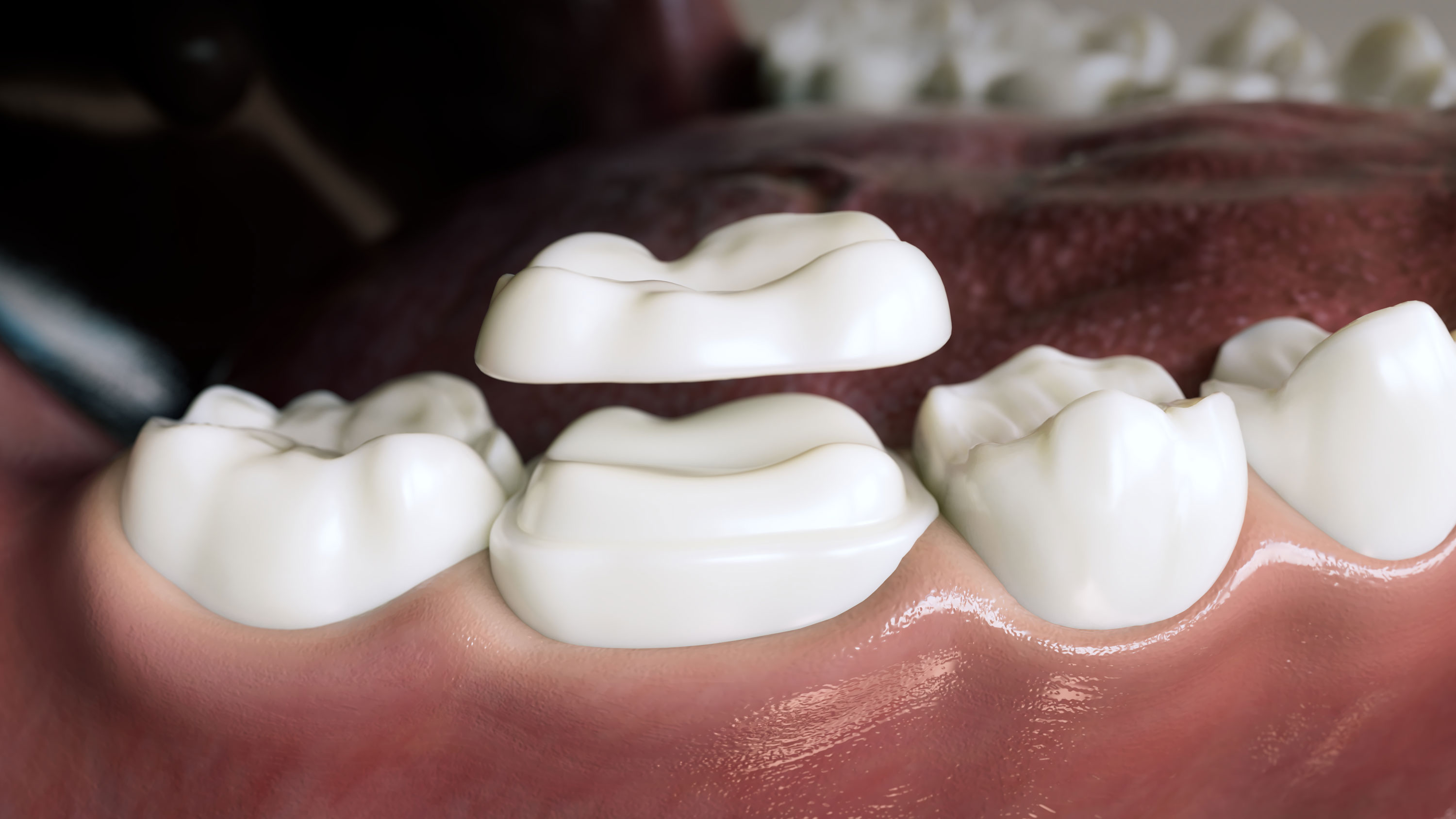 Greater Dental Health Greater Dental Health