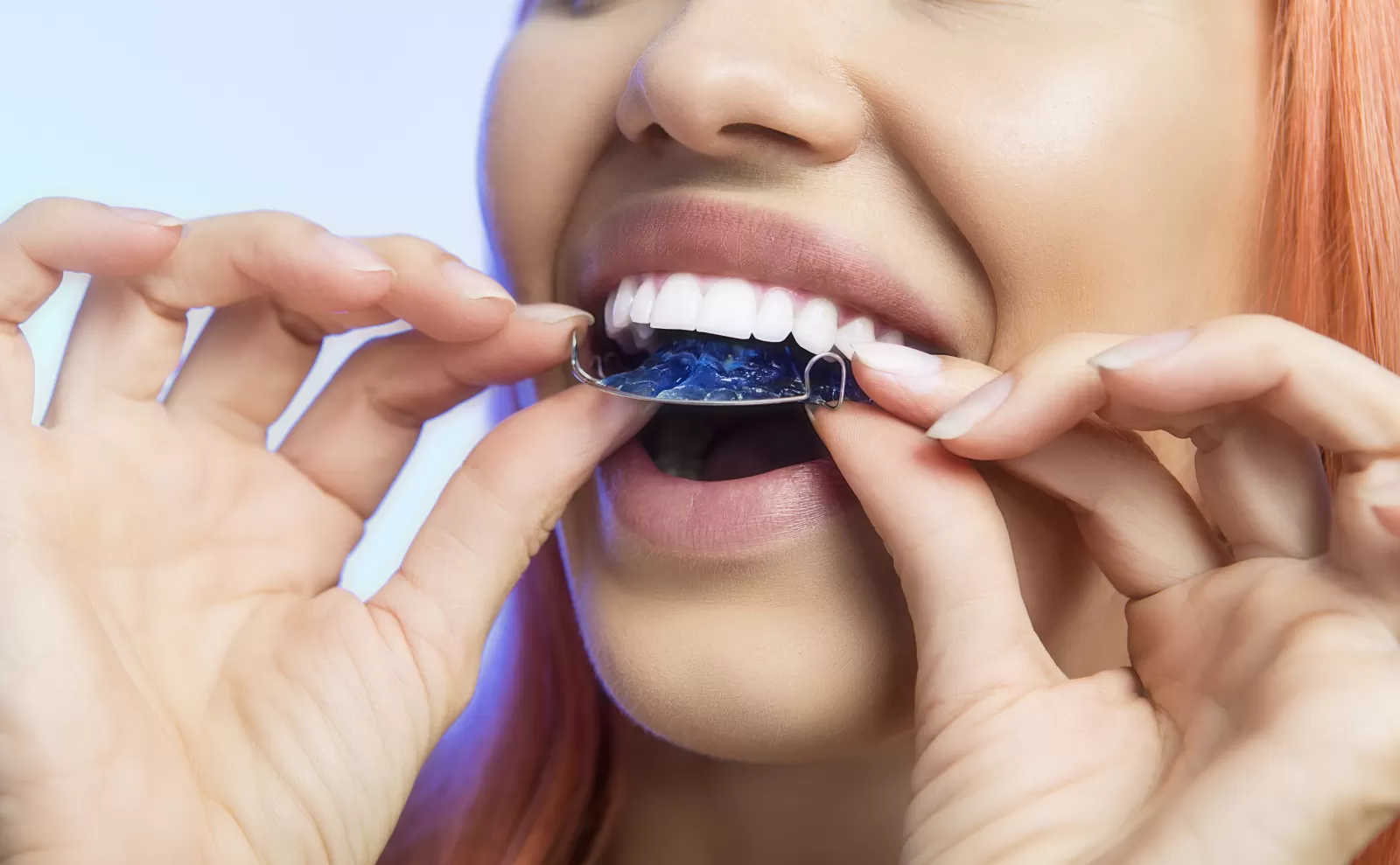 Knoxville Orthodontics Knoxville Orthodontics