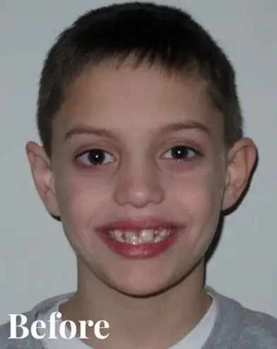 Knoxville Orthodontics Knoxville Orthodontics