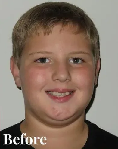 Knoxville Orthodontics Knoxville Orthodontics