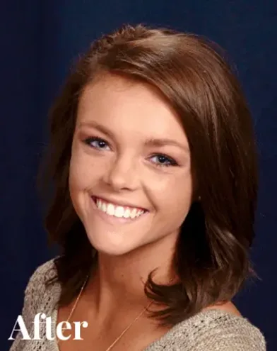 Knoxville Orthodontics Knoxville Orthodontics