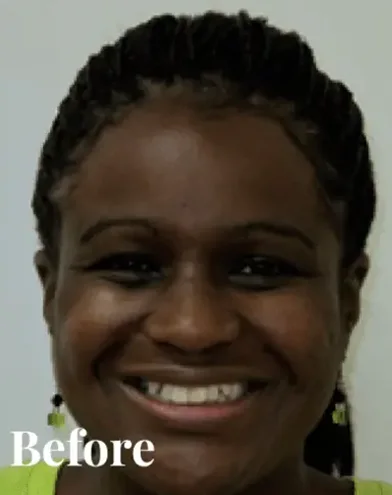 Knoxville Orthodontics Knoxville Orthodontics