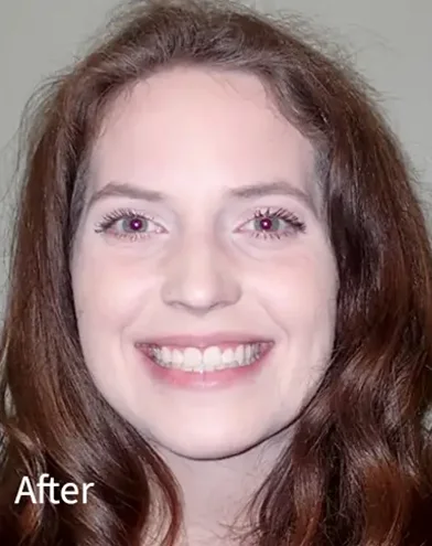 Knoxville Orthodontics Knoxville Orthodontics