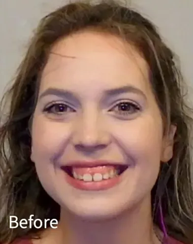 Knoxville Orthodontics Knoxville Orthodontics