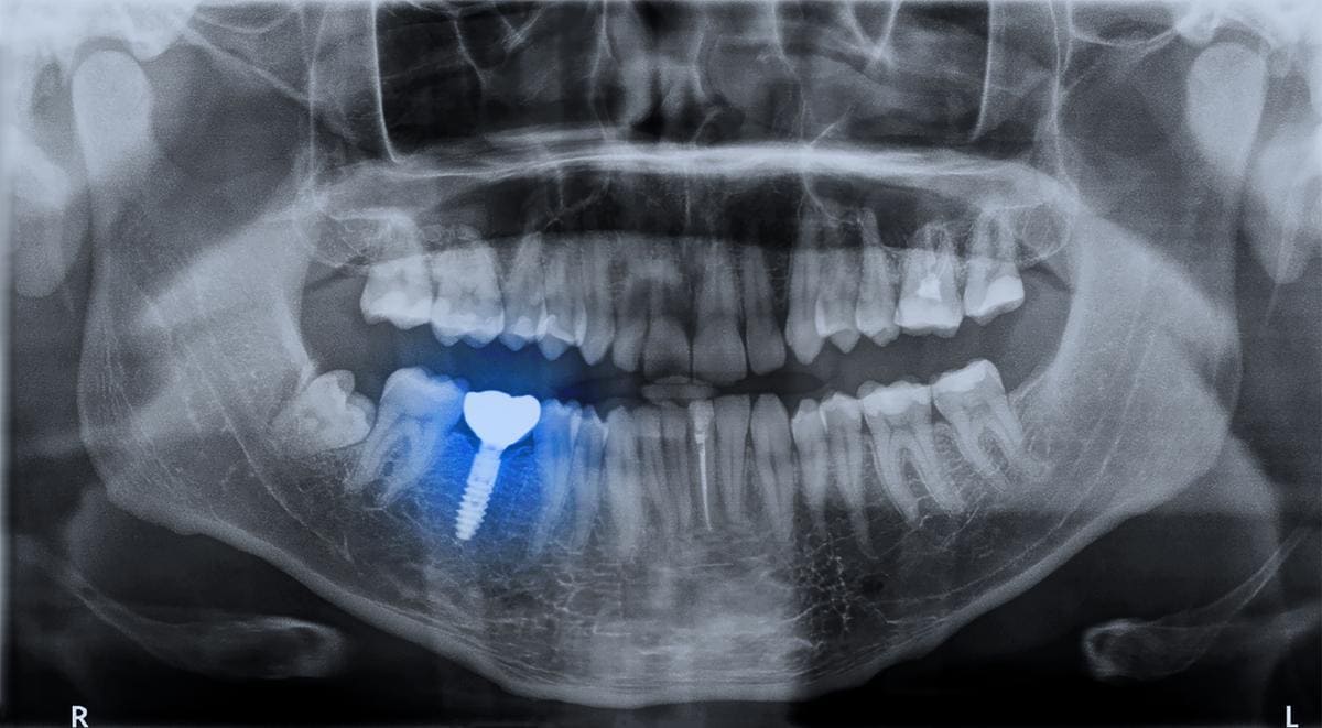 Best Dentist in Midland, TX Dr Be Smiles